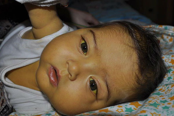 Цирроз печени: лечение Современные методы лечения - vequamysrea